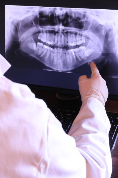 Best Emergency Root Canal Therapy in South Sarasota, FL